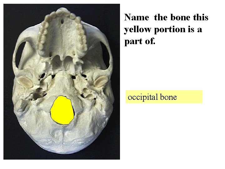 Name the bone this yellow portion is a part of. occipital bone 