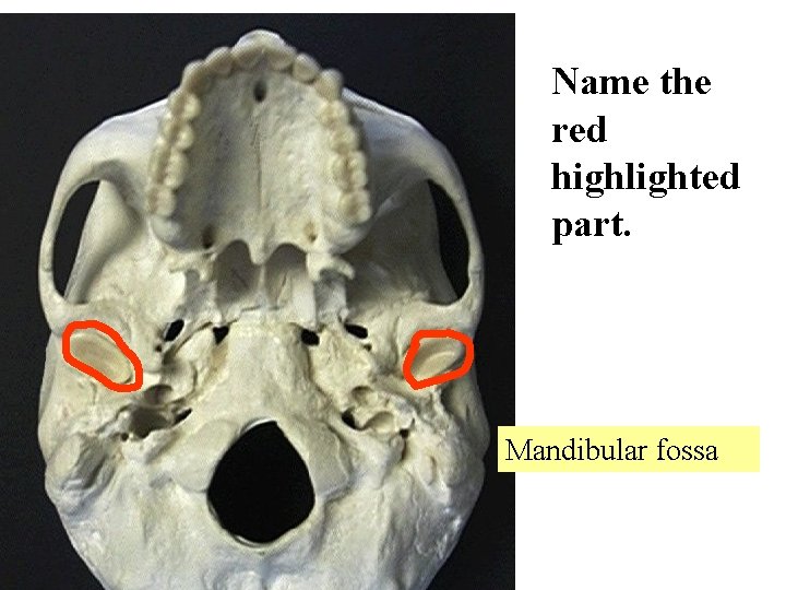 Name the red highlighted part. Mandibular fossa 