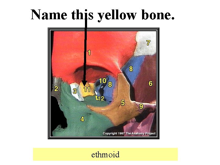 Name this yellow bone. ethmoid 