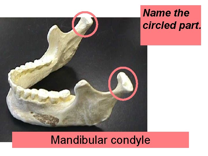 Name the circled part. Mandibular condyle 