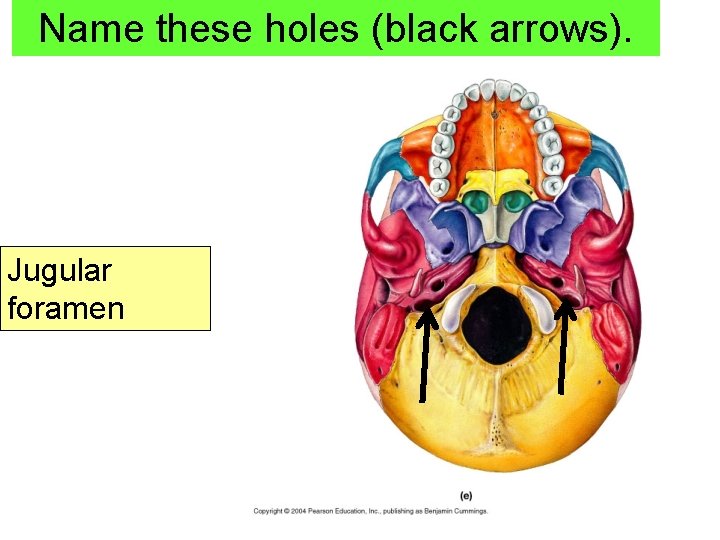 Name these holes (black arrows). Jugular foramen 