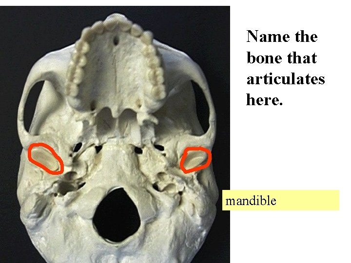 Name the bone that articulates here. mandible 