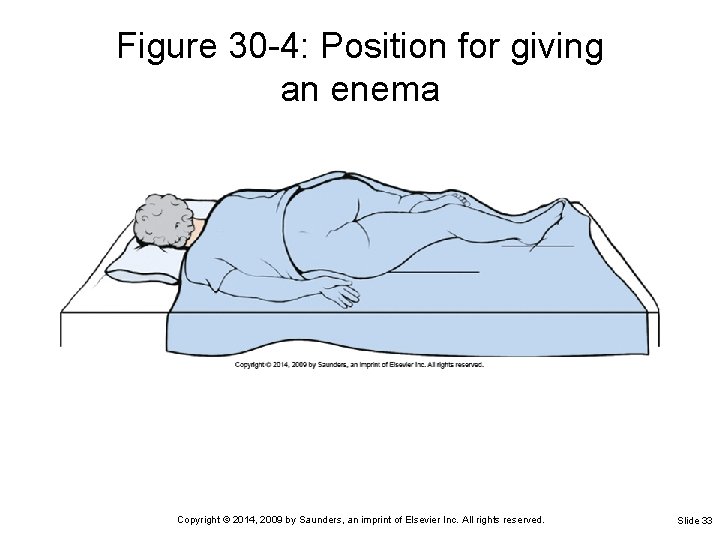 Figure 30 -4: Position for giving an enema Copyright © 2014, 2009 by Saunders,