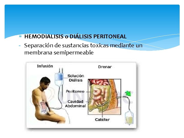  HEMODIALISIS o DIÁLISIS PERITONEAL - Separación de sustancias toxicas mediante un membrana semipermeable