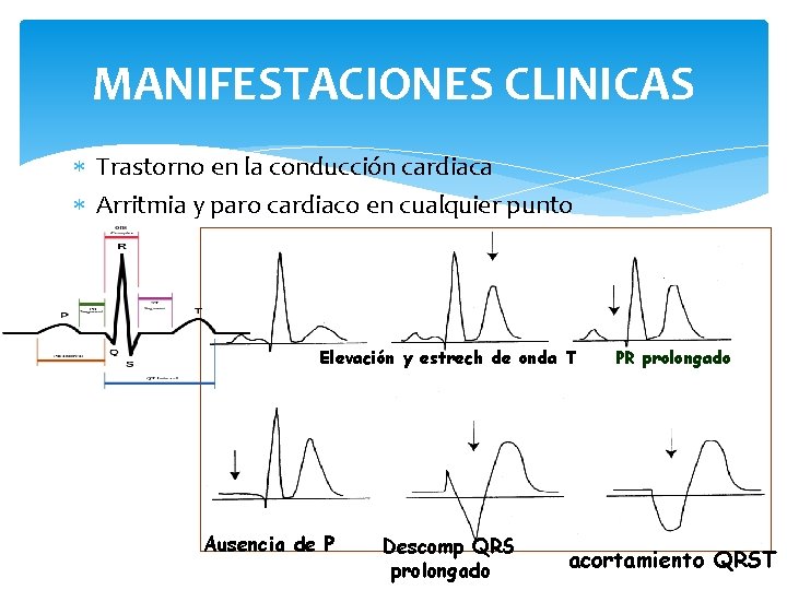 MANIFESTACIONES CLINICAS Trastorno en la conducción cardiaca Arritmia y paro cardiaco en cualquier punto