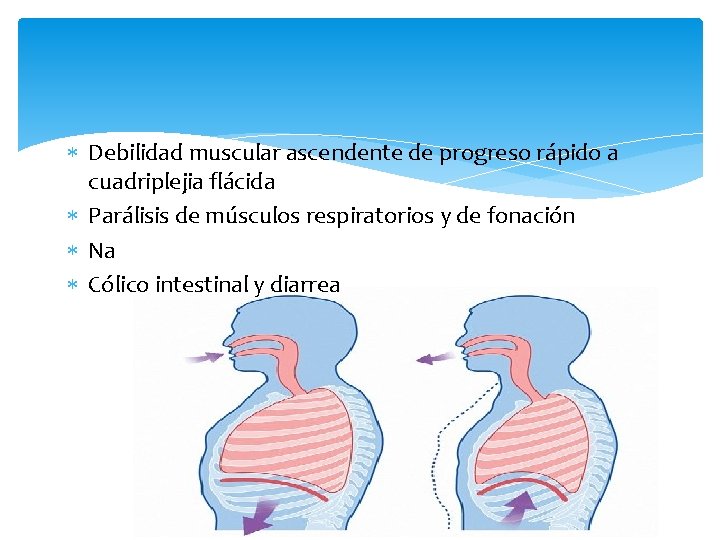  Debilidad muscular ascendente de progreso rápido a cuadriplejia flácida Parálisis de músculos respiratorios