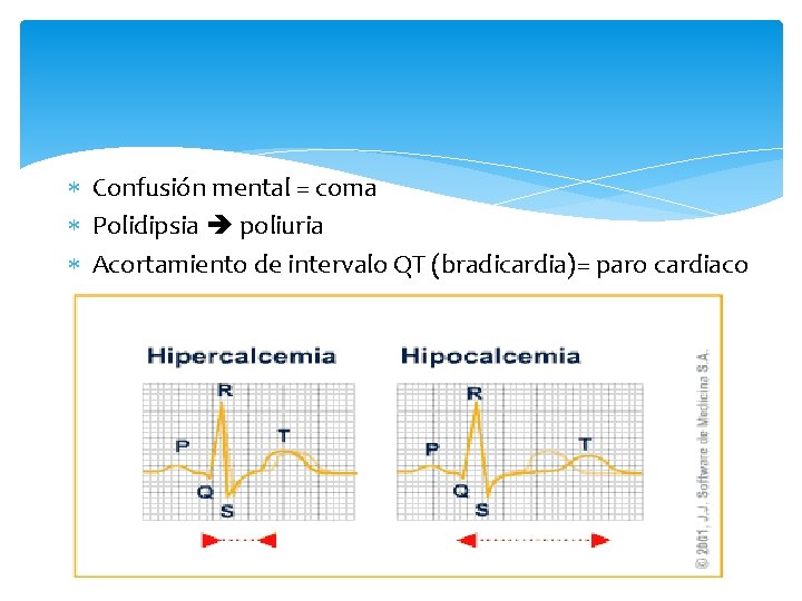  Confusión mental = coma Polidipsia poliuria Acortamiento de intervalo QT (bradicardia)= paro cardiaco