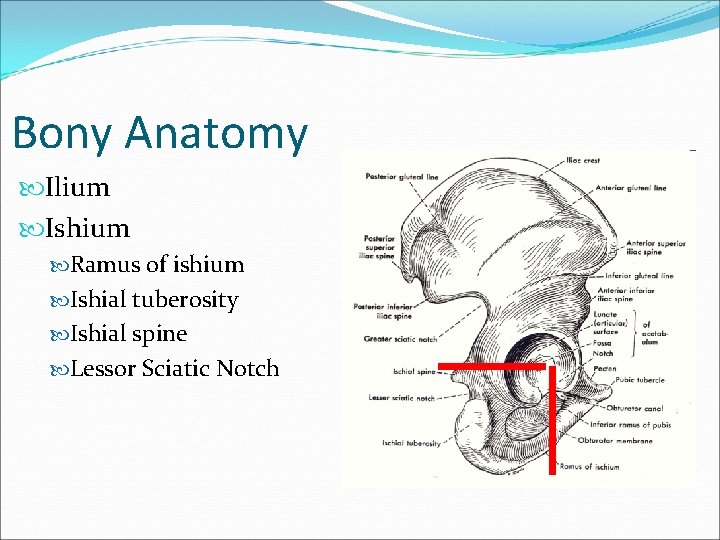 Bony Anatomy Ilium Ishium Ramus of ishium Ishial tuberosity Ishial spine Lessor Sciatic Notch