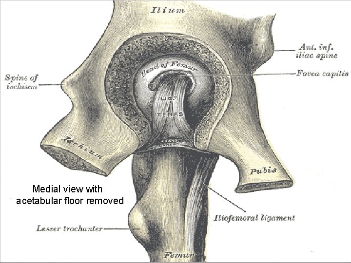 Medial view with acetabular floor removed 