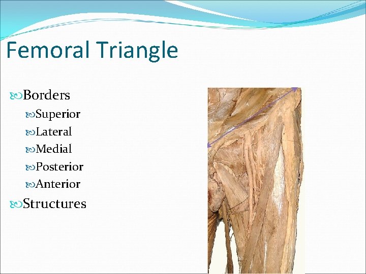 Femoral Triangle Borders Superior Lateral Medial Posterior Anterior Structures 