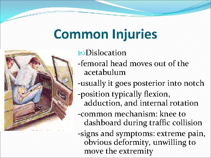 Common Injuries Dislocation -femoral head moves out of the acetabulum -usually it goes posterior