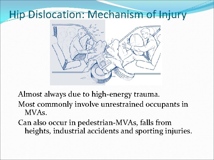 Hip Dislocation: Mechanism of Injury Almost always due to high-energy trauma. Most commonly involve