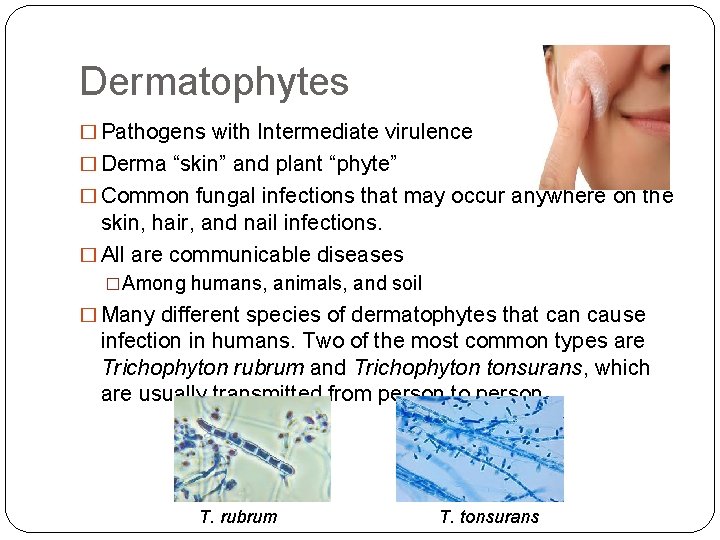 Dermatophytes � Pathogens with Intermediate virulence � Derma “skin” and plant “phyte” � Common
