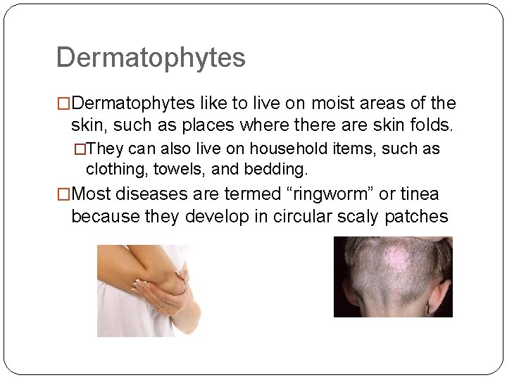 Dermatophytes �Dermatophytes like to live on moist areas of the skin, such as places