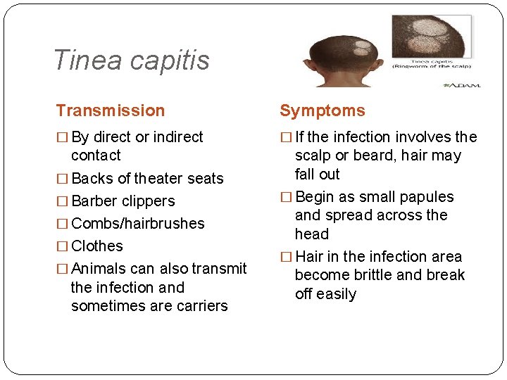 Tinea capitis Transmission Symptoms � By direct or indirect � If the infection involves
