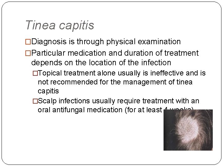 Tinea capitis �Diagnosis is through physical examination �Particular medication and duration of treatment depends