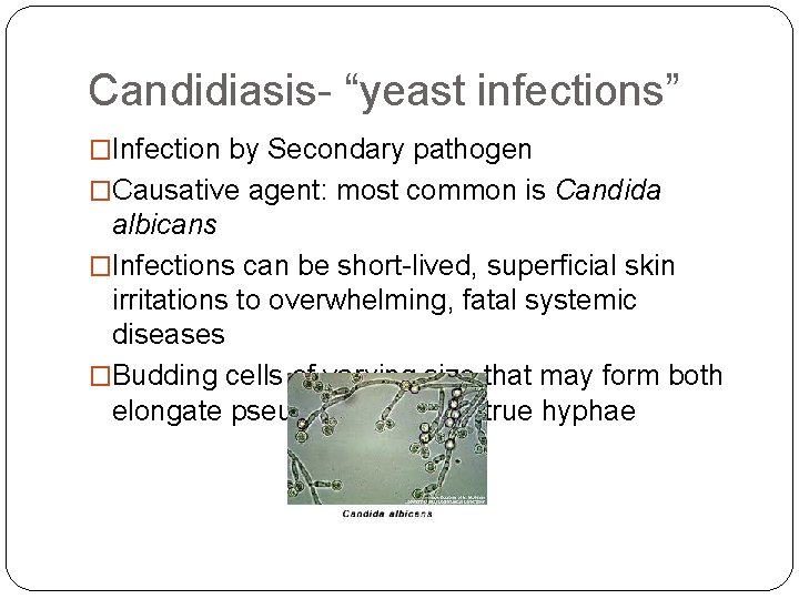 Candidiasis- “yeast infections” �Infection by Secondary pathogen �Causative agent: most common is Candida albicans