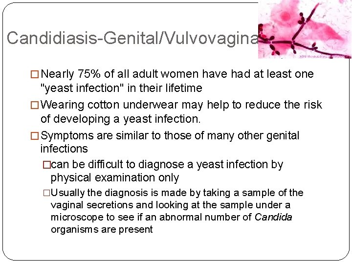 Candidiasis-Genital/Vulvovaginal � Nearly 75% of all adult women have had at least one "yeast