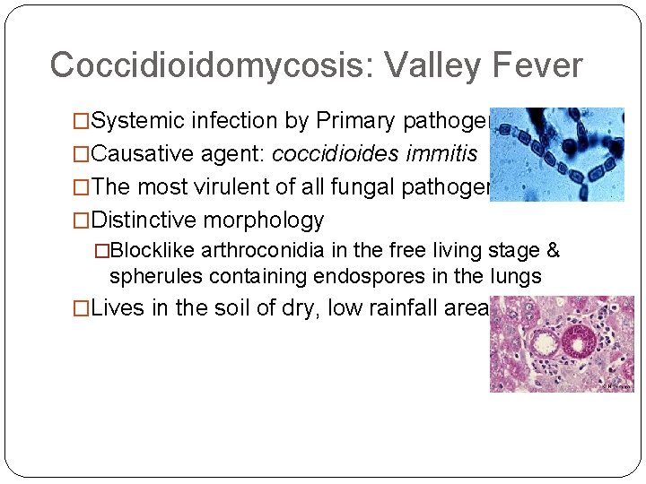 Coccidioidomycosis: Valley Fever �Systemic infection by Primary pathogen �Causative agent: coccidioides immitis �The most