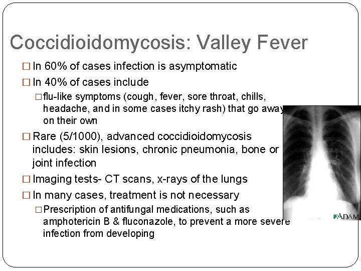 Coccidioidomycosis: Valley Fever � In 60% of cases infection is asymptomatic � In 40%