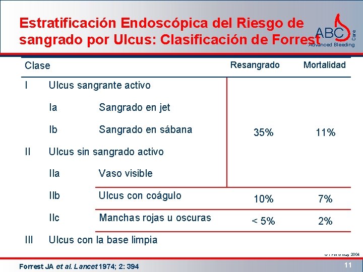 Care Estratificación Endoscópica del Riesgo de ABC sangrado por Ulcus: Clasificación de Forrest Advanced