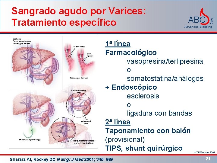 ABC Care Sangrado agudo por Varices: Tratamiento específico Advanced Bleeding 1ª línea Farmacológico vasopresina/terlipresina