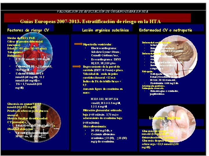 VALORACION DE AFECTACIÓN DE ÓRGANO-DIANA EN HTA Guías Europeas 2007 -2013. Estratificación de riesgo