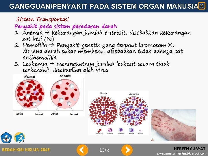 GANGGUAN/PENYAKIT PADA SISTEM ORGAN MANUSIA X Sistem Transportasi Penyakit pada sistem peredaran darah 1.