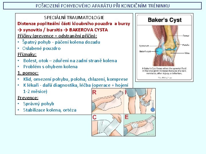 POŠKOZENÍ POHYBOVÉHO APARÁTU PŘI KONDIČNÍM TRÉNINKU SPECIÁLNÍ TRAUMATOLOGIE Distenze popliteální části kloubního pouzdra a