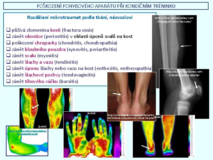 POŠKOZENÍ POHYBOVÉHO APARÁTU PŘI KONDIČNÍM TRÉNINKU Rozdělení mikrotraumat podle tkání, názvosloví https: //musculoskeletalkey. com