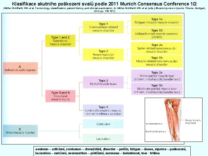 Klasifikace akutního poškození svalů podle 2011 Munich Consensus Conference 1/2 [Müller-Wohlfarth HW. et al.