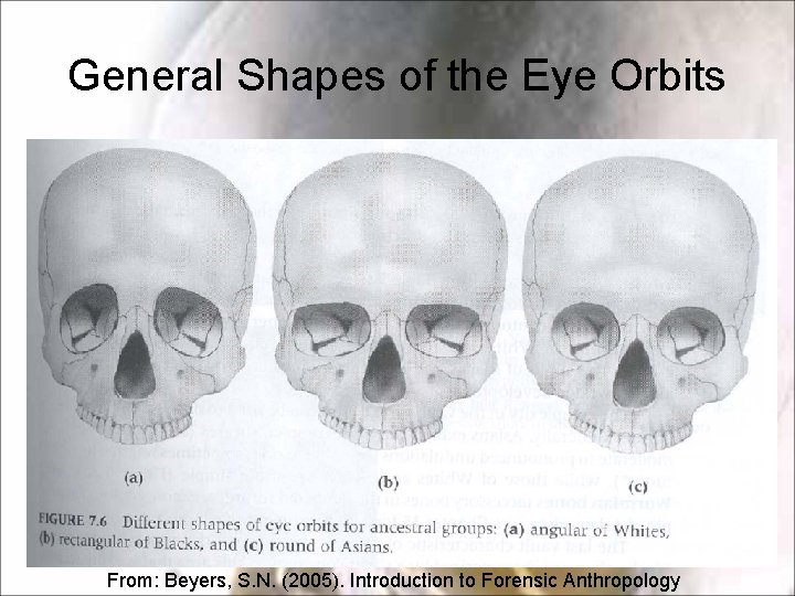 General Shapes of the Eye Orbits From: Beyers, S. N. (2005). Introduction to Forensic General Shapes of the Eye Orbits From: Beyers, S. N. (2005). Introduction to Forensic