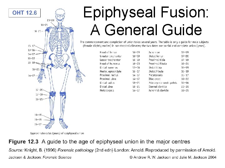 Epiphyseal Fusion: A General Guide Epiphyseal Fusion: A General Guide