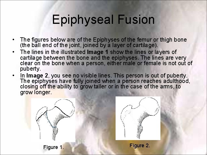 Epiphyseal Fusion • The figures below are of the Epiphyses of the femur or Epiphyseal Fusion • The figures below are of the Epiphyses of the femur or