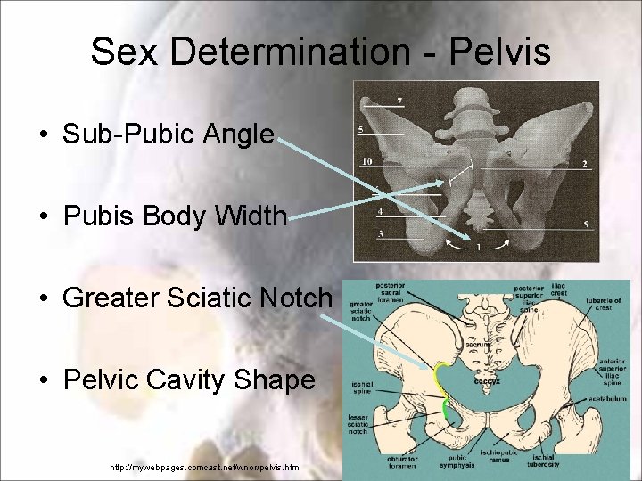 Sex Determination - Pelvis • Sub-Pubic Angle • Pubis Body Width • Greater Sciatic Sex Determination - Pelvis • Sub-Pubic Angle • Pubis Body Width • Greater Sciatic