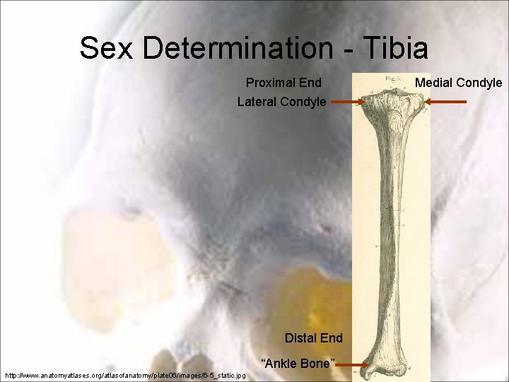 Sex Determination - Tibia Proximal End Lateral Condyle Distal End “Ankle Bone” http: //www. Sex Determination - Tibia Proximal End Lateral Condyle Distal End “Ankle Bone” http: //www.