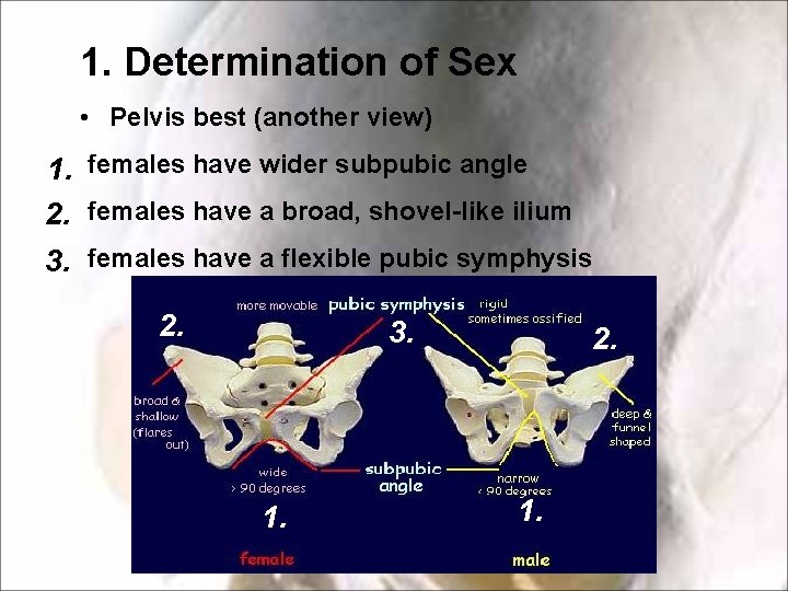 1. Determination of Sex • Pelvis best (another view) 1. females have wider subpubic 1. Determination of Sex • Pelvis best (another view) 1. females have wider subpubic