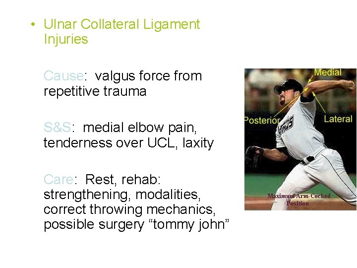  • Ulnar Collateral Ligament Injuries Cause: valgus force from repetitive trauma S&S: medial