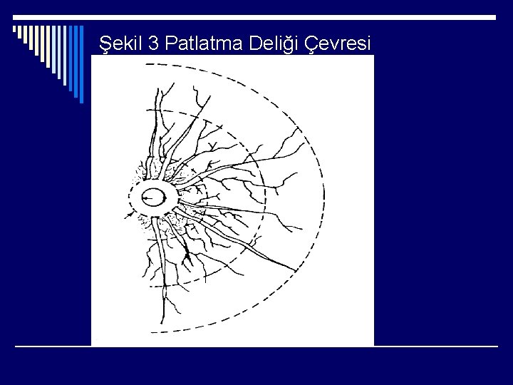 Şekil 3 Patlatma Deliği Çevresi 