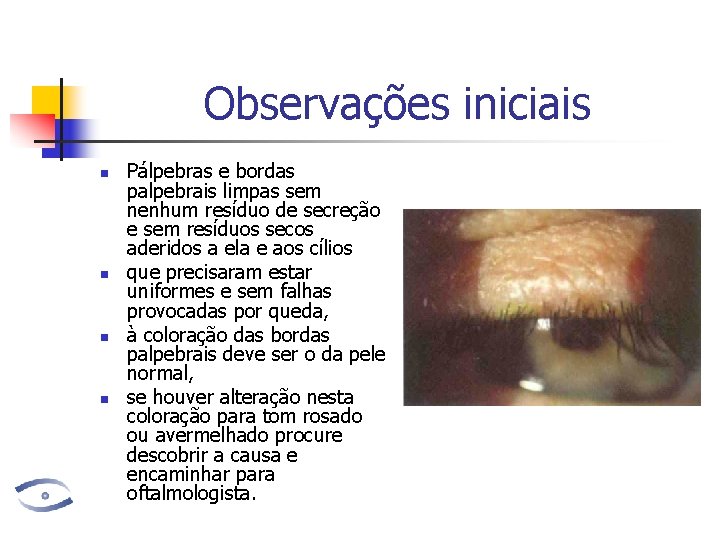 Observações iniciais n n Pálpebras e bordas palpebrais limpas sem nenhum resíduo de secreção