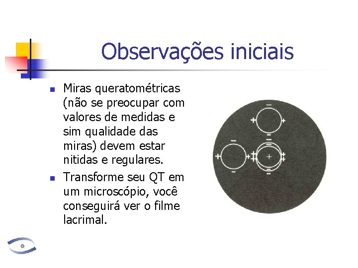 Observações iniciais n n Miras queratométricas (não se preocupar com valores de medidas e