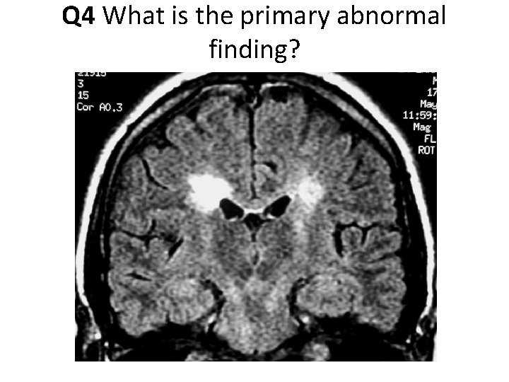 Q 4 What is the primary abnormal finding? 