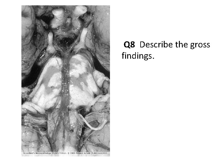 Q 8 Describe the gross findings. 