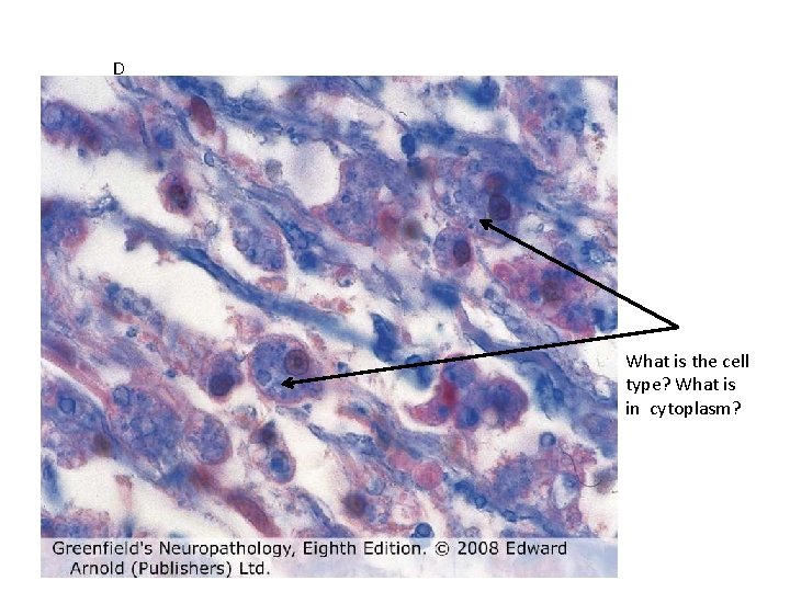 D What is the cell type? What is in cytoplasm? 