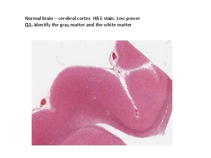 Normal brain – cerebral cortex H&E stain. Low power Q 1. Identify the gray