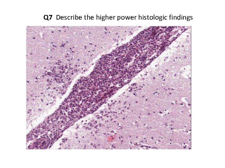 Q 7 Describe the higher power histologic findings 