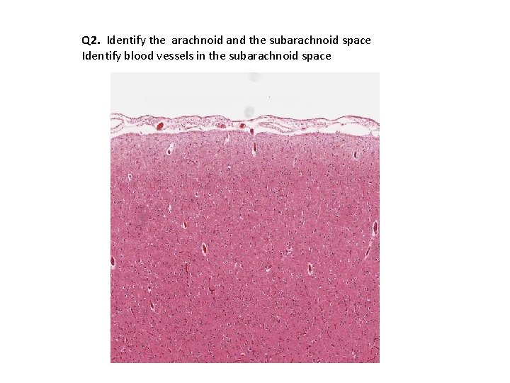 Q 2. Identify the arachnoid and the subarachnoid space Identify blood vessels in the