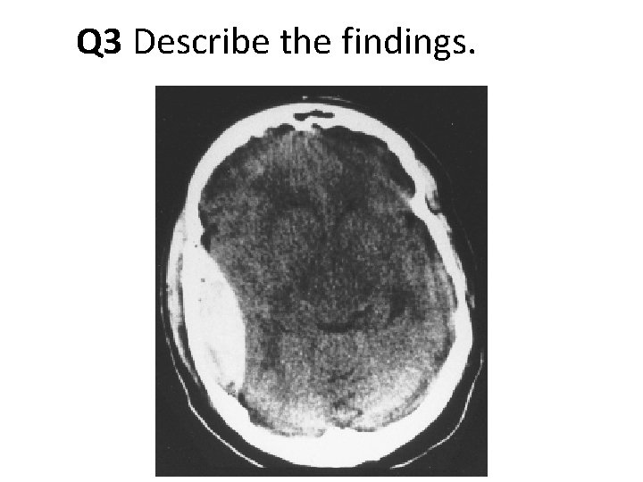 Q 3 Describe the findings. 