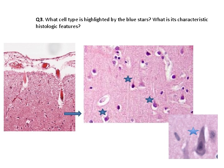 Q 3. What cell type is highlighted by the blue stars? What is its