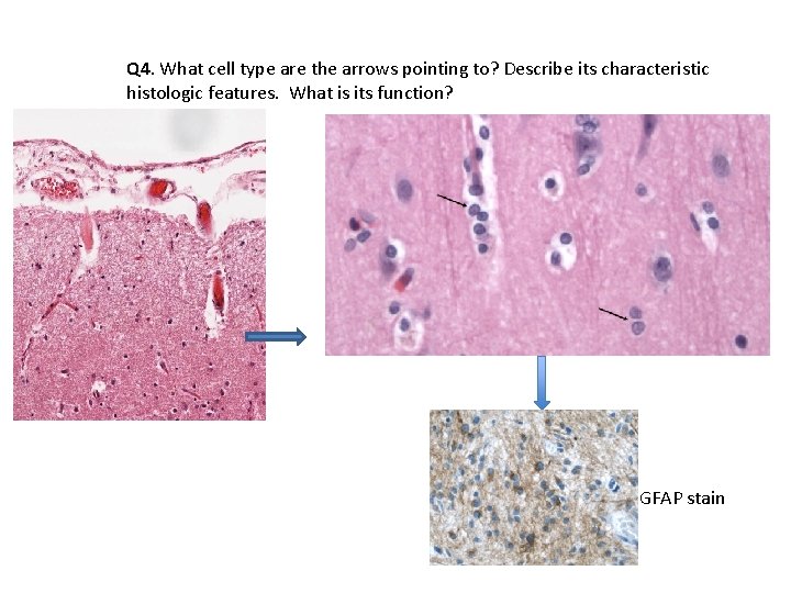 Q 4. What cell type are the arrows pointing to? Describe its characteristic histologic